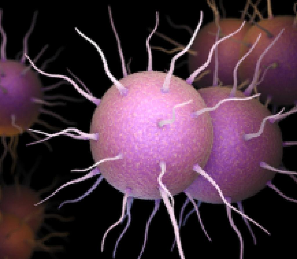 Vista microscópica de una célula con infección gonocócica diseminada (IGD)